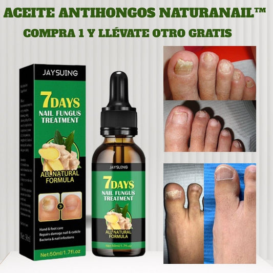 NaturaNail™ - ¡Resultados en una semana! (1+1 GRATIS)